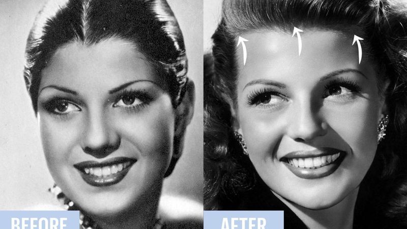Tape Face Lifts